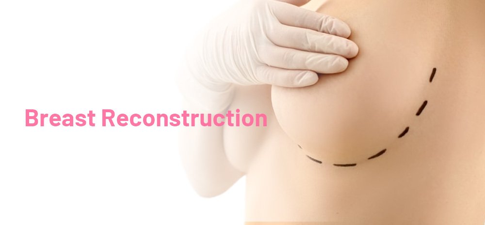 Breast Reconstruction